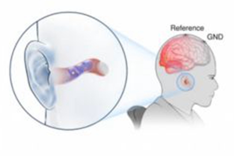 腦機接口的又一裡程碑？基於耳內生物電子學的“智能高適應”！